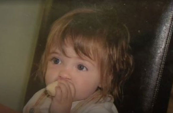Foto: Reprodução BBC/ Rachel foi diagnosticada com Síndrome Alcoólica Fetal aos seis anos de idade