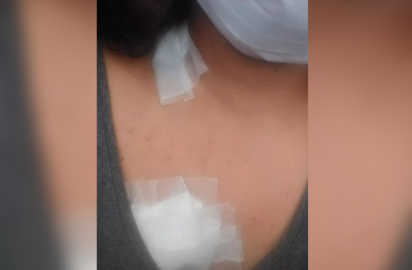 Adolescente foi atingida no peito e no pescoço — Foto: Arquivo Pessoal