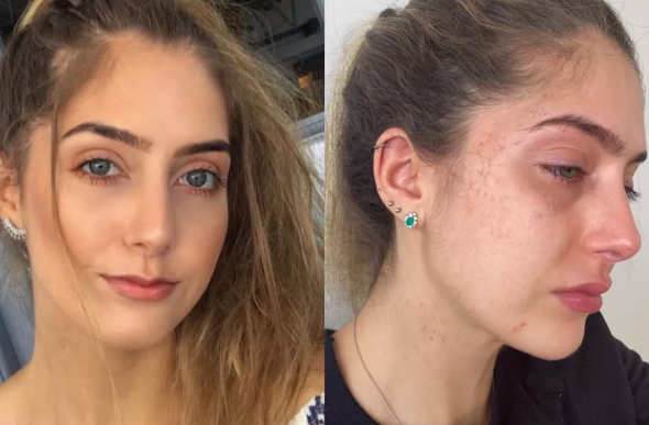 Gabriela Campos Duarte Machado, 22 anos, diz que sofreu agressões do ex-namorado, em BH. Na foto da esquerda, ela antes de ser agredida e, na direita, após a violência — Foto: Redes Sociais