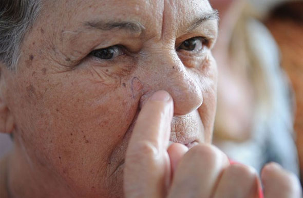 Foto: Foto: Fabio Rodrigues Pozzebom/Agência Brasil/ A agência solicitou que os profissionais de saúde informem aos pacientes tratados com hidroclorotiazida sobre o risco de câncer de pele