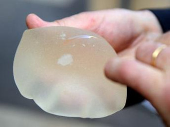 Próteses de silicone da empresa francesa PIP devem ser substituídas
