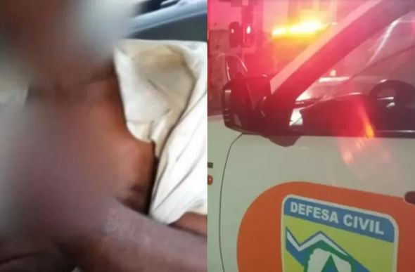Homem tem mão decepada após cobrar pagamento por serviço prestado no Paraná - Foto: Reprodução