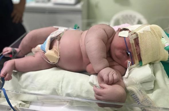 'Bebê gigante,' Angerson Santos, nasceu com mais de 7kg, em Parintins, no interior do AM. — Foto: Divulgação/Hospital Padre Colombo